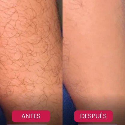 ¡Por fin, una Piel perfecta sin Sufrimiento!