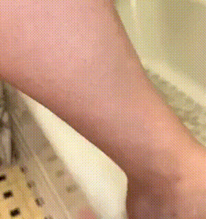 ¡Por fin, una Piel perfecta sin Sufrimiento!